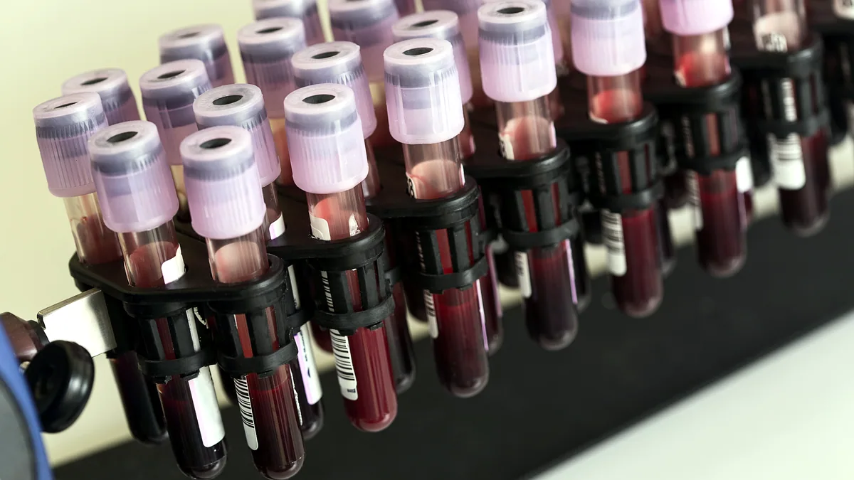 A small glass vial of red blood resting on a clean white laboratory tray.